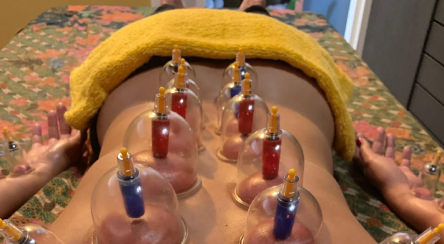 Massage  Los Cristianos, Sak Thong Thai Massage and Therapy Tenerife - Cupping Therapy Massage